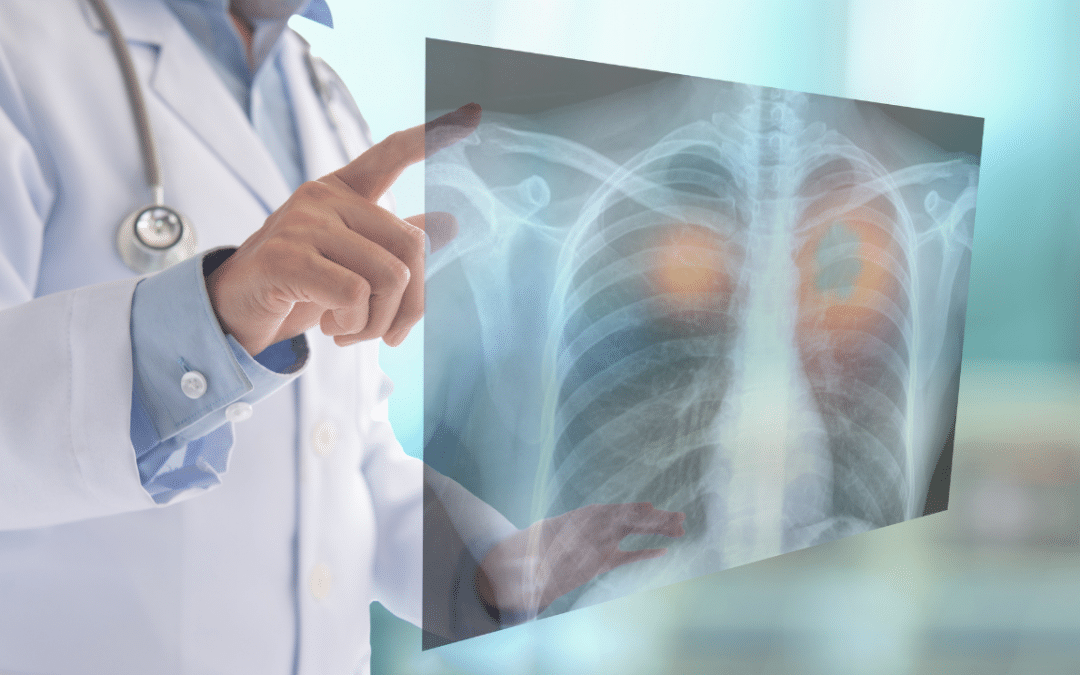 How Are X-Rays Revolutionizing Diagnostic and Therapeutic Procedures?