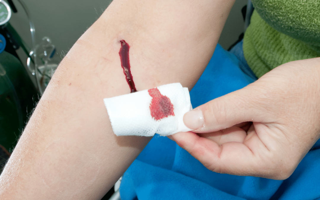 How Can Recognizing the Risks of Tetanus Save Lives Following a Puncture Wound?